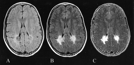 fig 2.