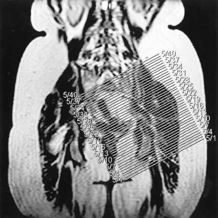 fig 1.