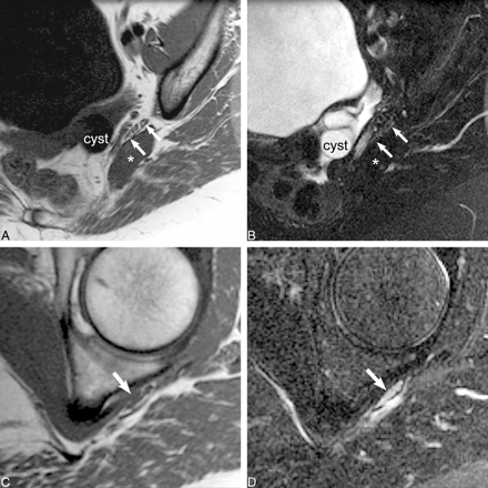 fig 4.