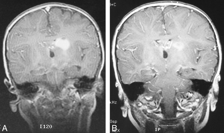 fig 2.