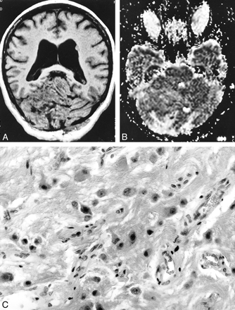 fig 1.