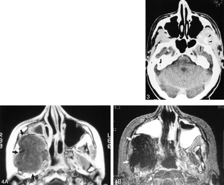 fig 3.