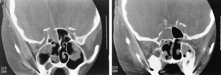 fig 1.