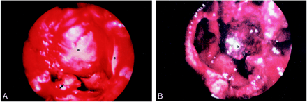 fig 2.