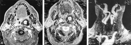 fig 2.