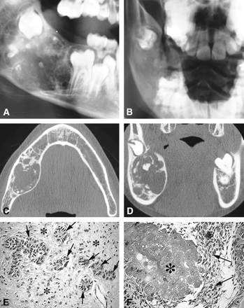 fig 1.