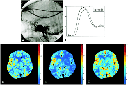 fig 4.
