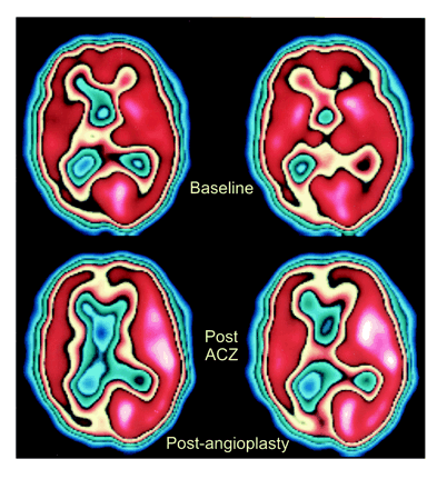 fig 3.