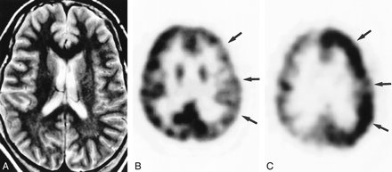fig 2.