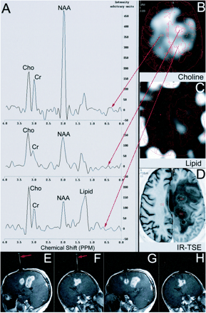 fig 3.
