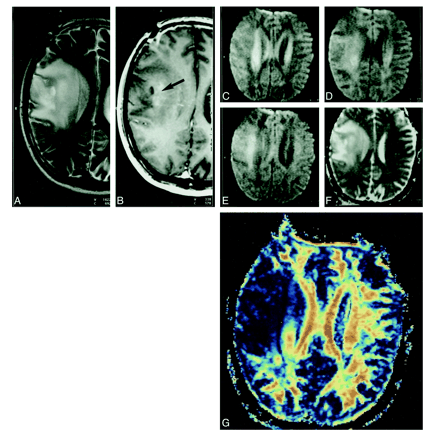 fig 1.