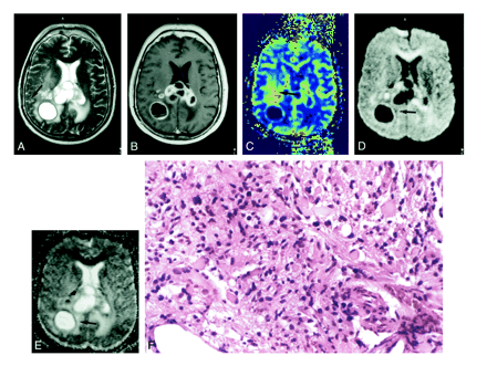 fig 2.