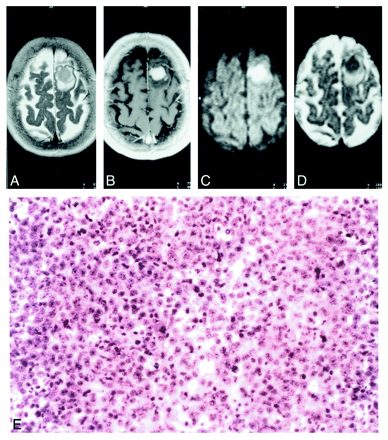 fig 2.