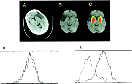 fig 1.