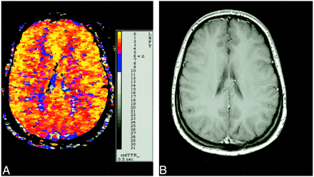 fig 1.