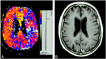 fig 3.