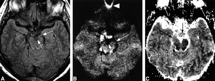 fig 3.