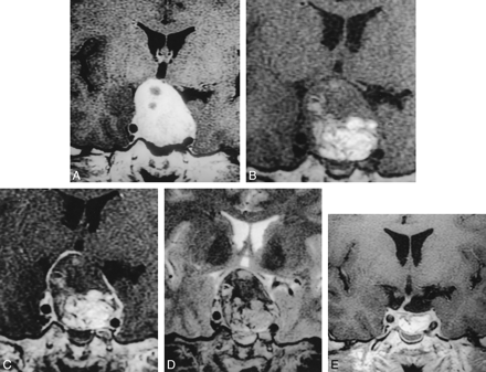 fig 2.