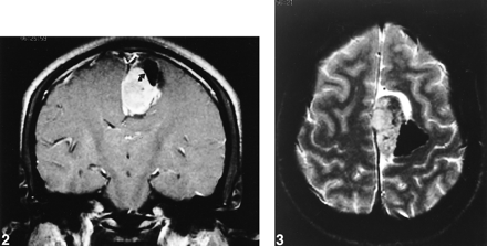 fig 2.
