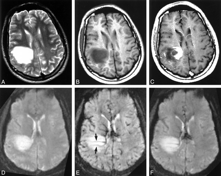 fig 3.