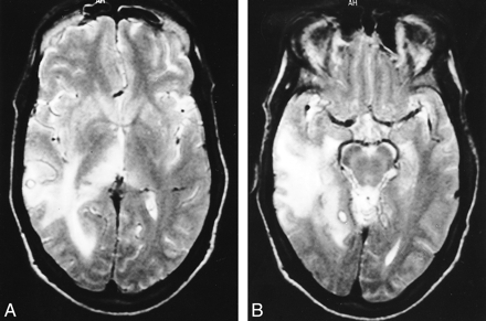 fig 3.