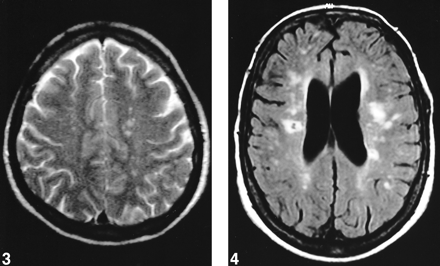 fig 3.
