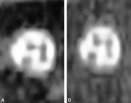 fig 3.