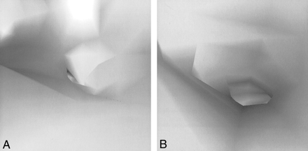 fig 6.