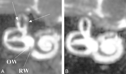 fig 7.