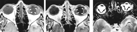 fig 4.