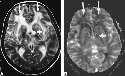 fig 3.