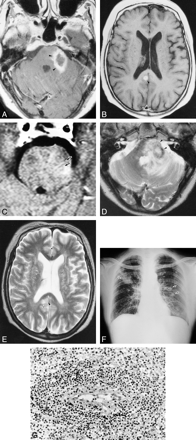 fig 4.