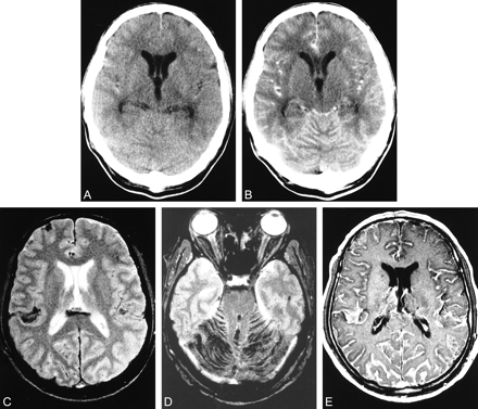 fig 1.