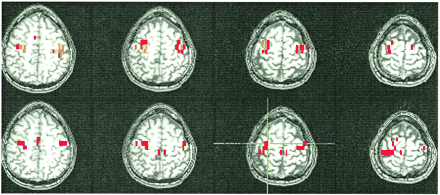fig 4.