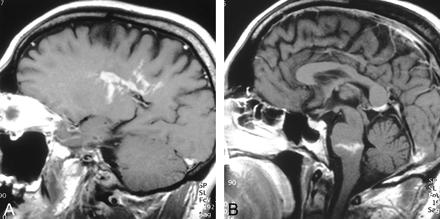 fig 1.