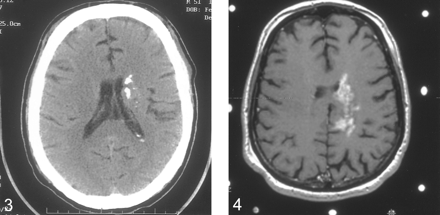 fig 3.