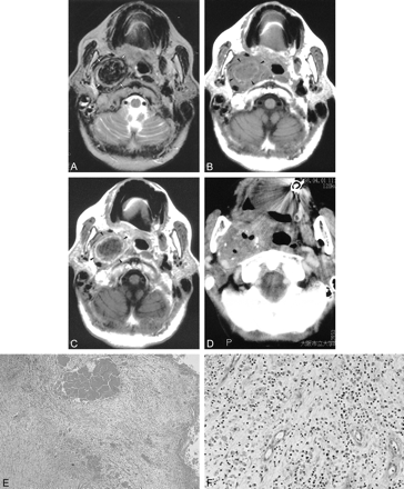 fig 1.