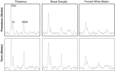 fig 3.