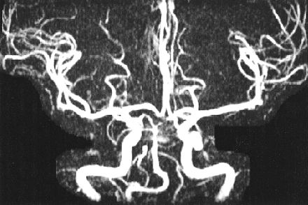 fig 3.