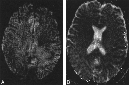 fig 4.
