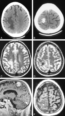 fig 1.