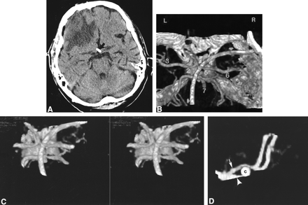 fig 1.