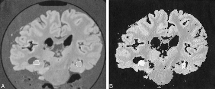 fig 1.