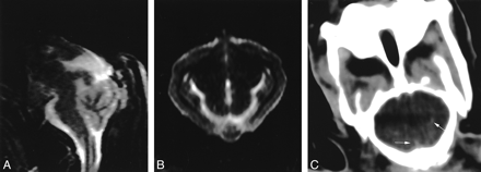 fig 2.