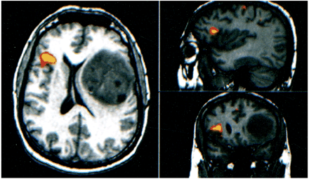fig 2.
