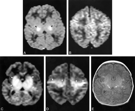 fig 2.