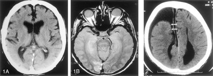Fig 1.