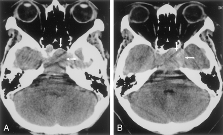 Fig 3.