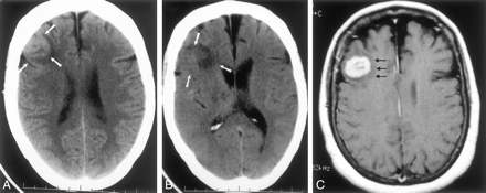 Fig 4.