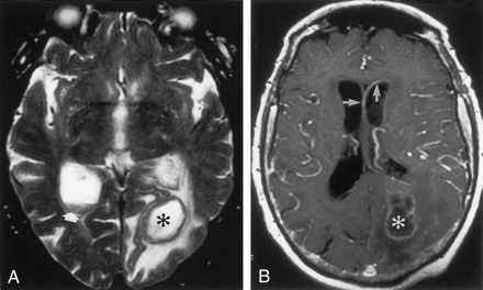 Fig 1.